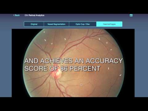 IBM Machine Vision Technology Advances Early Detection of Diabetic Eye Disease Using Deep Learning